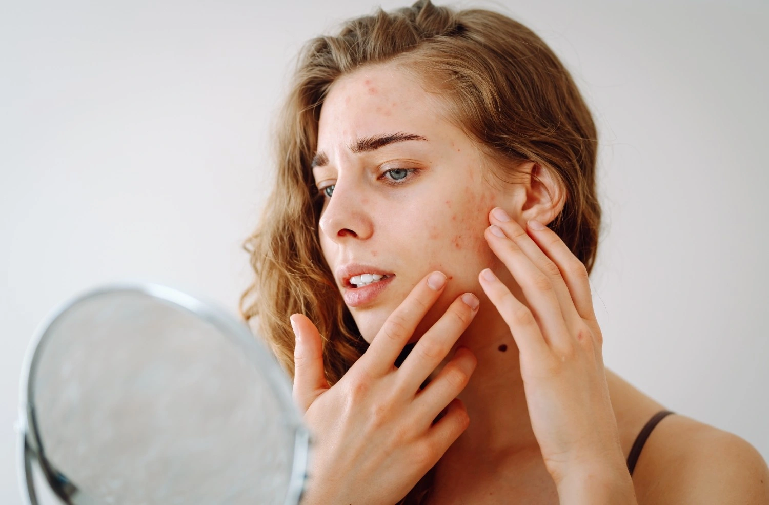 A Woman seeing in a mirror for acne scars and stretch marks | Missouri City, TX